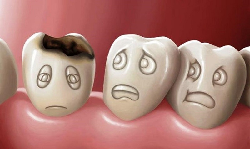 [TƯ VẤN] Bầu nhổ răng được không? Bà bầu bị sâu răng có hàn được không?