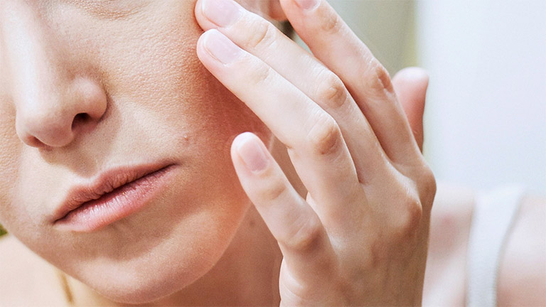Da mặt khô nên dùng gì? Cách trị da mặt khô sần, khô rát đỏ, bong tróc |  Omi Pharma