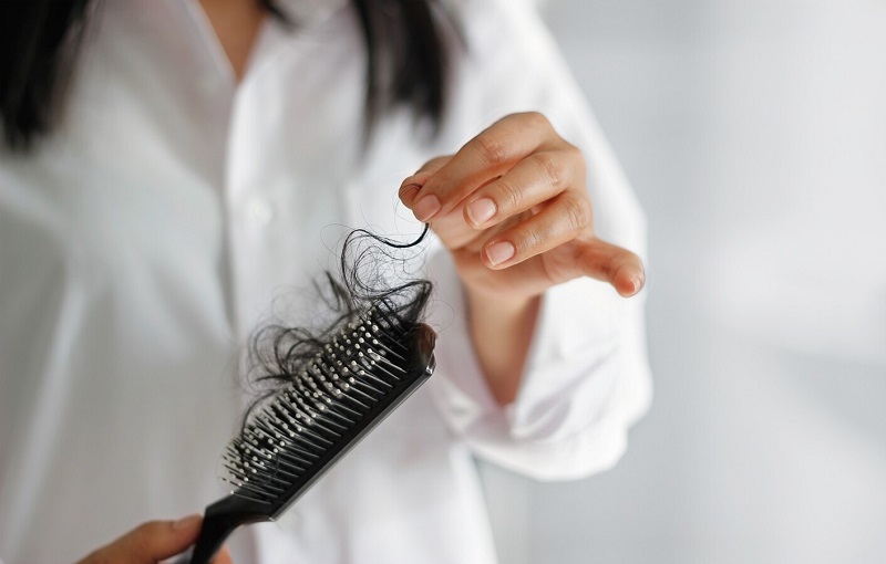 [TƯ VẤN] Bị rụng tóc nhiều phải làm sao? Rụng tóc nhiều ở nữ là bệnh gì?