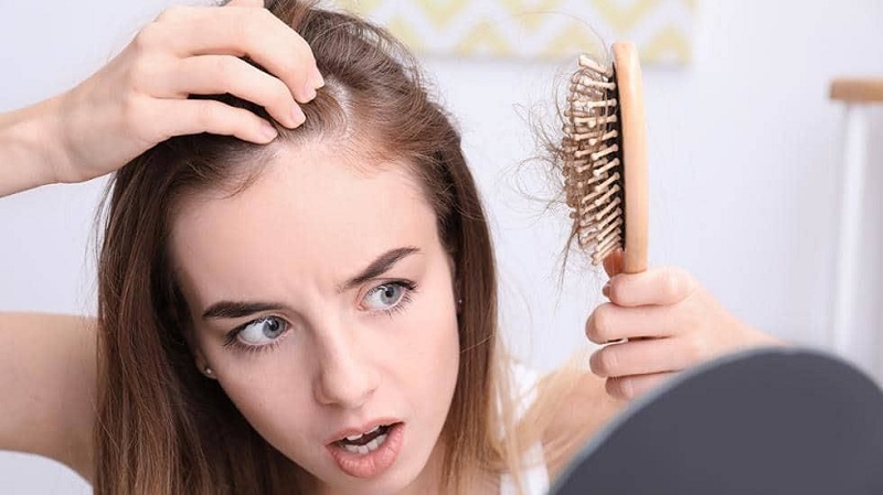 [TƯ VẤN] Bị rụng tóc nhiều phải làm sao? Rụng tóc nhiều ở nữ là bệnh gì?-1